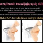 zęby mleczne (8)